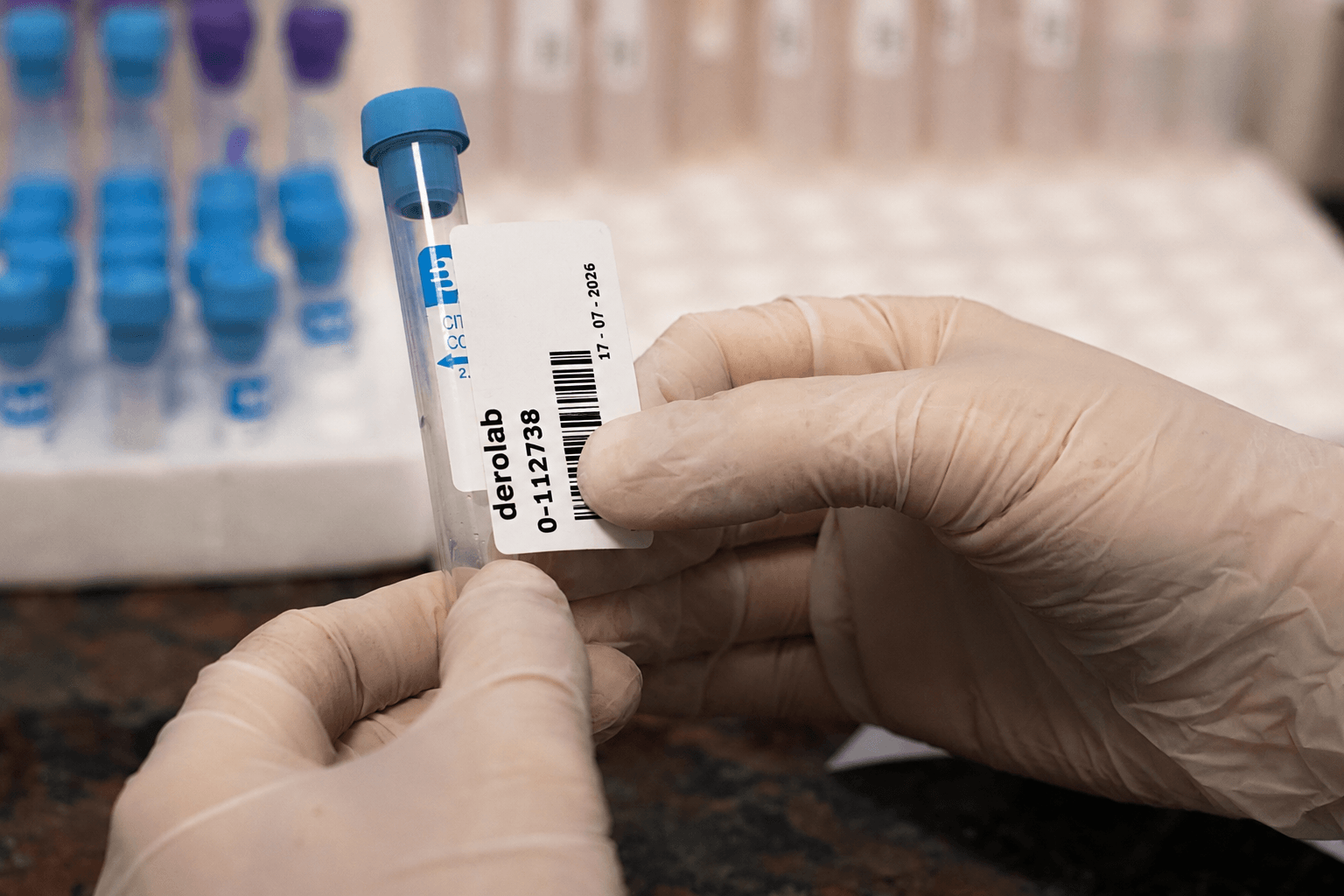 tubo de recolección de muestras biológicas